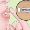 Trate rapidamente a acne ao redor dos lábios