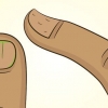 Curar unhas danificadas