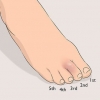 Usando fita adesiva para um dedo do pé lesionado