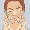 Esfoliar a pele