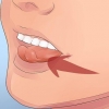 Perder um dente solto sem puxá-lo