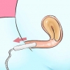Remover um tampão