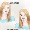 Tratamento da hiperpigmentação