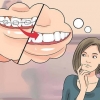 Preparando-se para o dia em que você colocar o aparelho