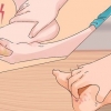 Tratamento de pés de trincheira