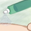 Prevenção de picadas de mosquito