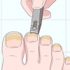 Tratamento de unhas fúngicas