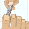 Esconder unhas fúngicas