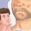 Tratamento do eczema seborreico no rosto