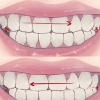 Pare de ranger os dentes enquanto dorme