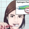 Clareamento dental com peróxido de hidrogênio