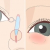Como se livrar de um ducto lacrimal entupido