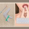 Saiba por que você não menstrua mais