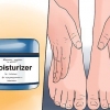 Trate o eczema de inverno