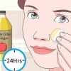 Remover verrugas no rosto