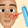 Faça seu próprio tratamento para acne
