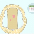 Reconhecendo o sangramento anormal entre os períodos menstruais