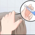 Trate a acne no couro cabeludo