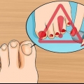 Livre-se das unhas amarelas