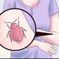Tratamento de picadas de percevejos