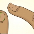 Curar unhas danificadas