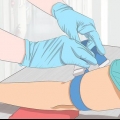 Tirar sangue de uma veia problemática
