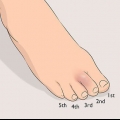Usando fita adesiva para um dedo do pé lesionado