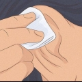Cure inchaços na cartilagem ao redor do seu piercing