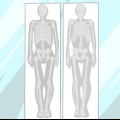Entendendo os resultados de uma cintilografia óssea
