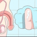 Reconhecendo os sintomas da clamídia (para homens)