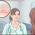 Aliviando os sintomas da dermatite espongiótica