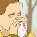 Tratando o eczema ao redor dos olhos