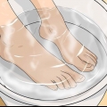 Remover calos