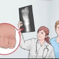 Enfaixando um dedo quebrado