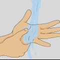 Dando uma massagem na cabeça