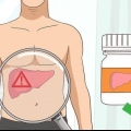 Tratamento da fosfatase alcalina alta