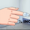 Tratando uma unha encravada
