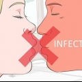 Prevenindo uma afta