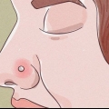 Tratando um piercing no nariz inflamado