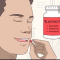Tratando uma infecção da glândula salivar