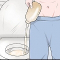 Troca de bolsa de ostomia