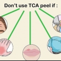 Aplicando um peeling de tca