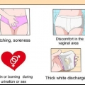 Tratando uma infecção vaginal