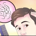 Descubra se você está ficando careca