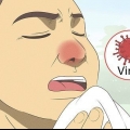 Reconhecendo a diferença entre amigdalite bacteriana e viral