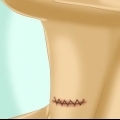 Cuidando da sua incisão após a cirurgia da tireoide