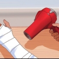 Você coça quando está coçando sob o gesso
