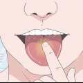Cure sua língua depois de comer doces