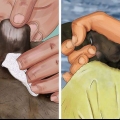 Tratamento da febre em cães