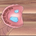 Removendo o adesivo de dentadura das gengivas